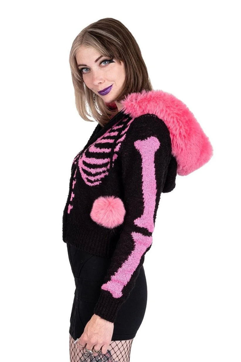 Bony Rib Cage Skeleton Fur Sweater [BLACK/PINK] - Image 5